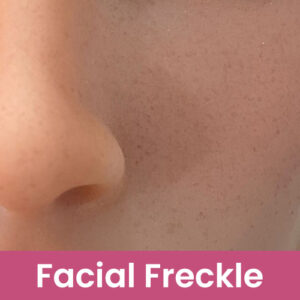 SE Doll Custom Option - Freckles